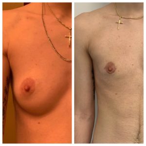 female to male procedures
