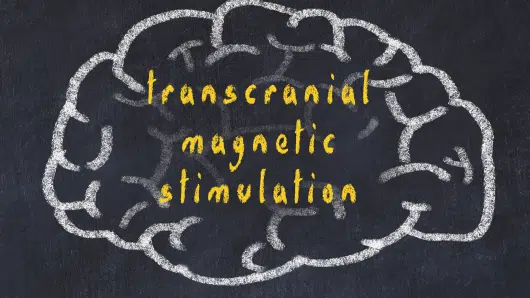 Transcranial Magnetic Stimulation or TMS