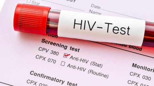 How Soon Should I Get Tested for HIV After Condomless Sex?