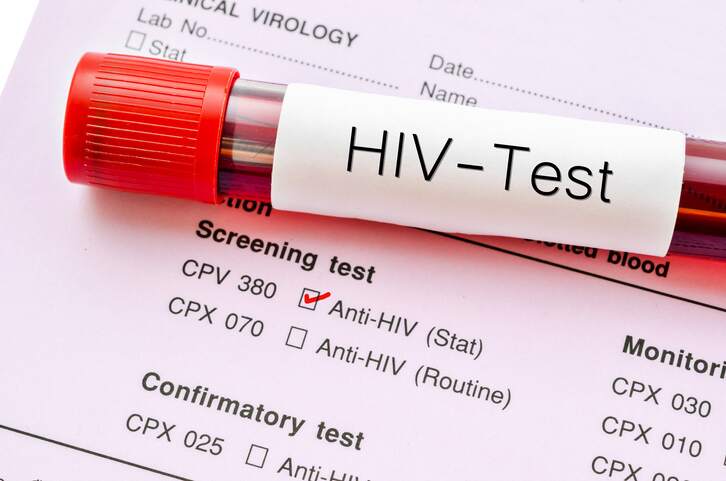 How Soon Should I Get Tested for HIV After Condomless Sex?